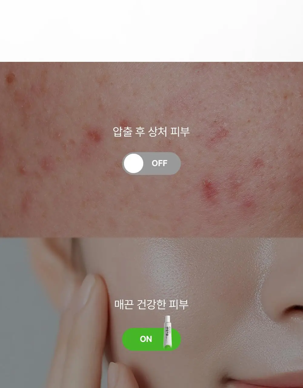 [의약외품] 동아제약 센테카솔 연고 30g 상세페이지 7